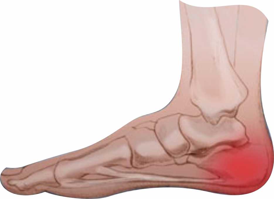 PieDolorTalon